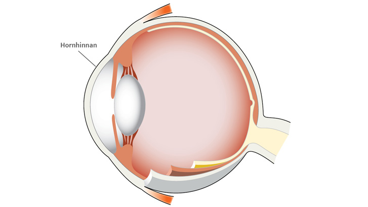 Hornhinnan bryter ljuset i ögat.