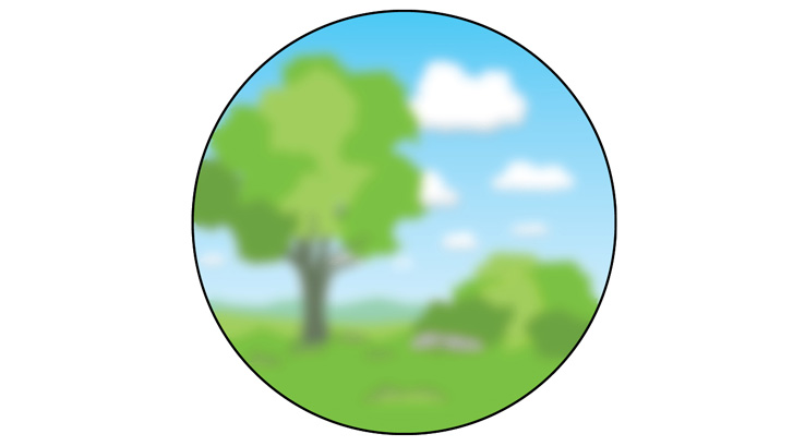 Efterstarr gör linskapseln grumlig och synen suddig.