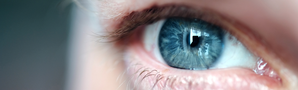 Är risken större för inflammation i hornhinnan av kontaktlinser än laser?